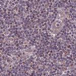 SUCLA2 Antibody in Immunohistochemistry (IHC)