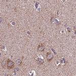 SUCLA2 Antibody in Immunohistochemistry (IHC)