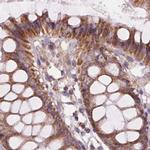 SUCLA2 Antibody in Immunohistochemistry (IHC)