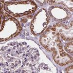 SUCLA2 Antibody in Immunohistochemistry (IHC)