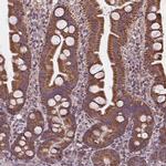 SUCLA2 Antibody in Immunohistochemistry (IHC)