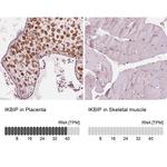 IKBIP Antibody in Immunohistochemistry (IHC)