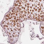 IKBIP Antibody in Immunohistochemistry (IHC)