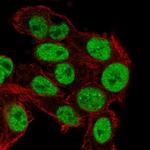 TRIM24 Antibody in Immunocytochemistry (ICC/IF)