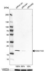 KIAA1143 Antibody