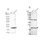 KIAA1143 Antibody in Western Blot (WB)