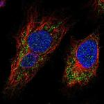 MTX3 Antibody in Immunocytochemistry (ICC/IF)