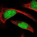 ECE2 Antibody in Immunocytochemistry (ICC/IF)