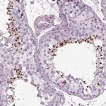 PDC Antibody in Immunohistochemistry (IHC)