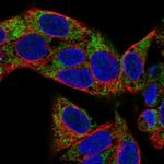 VARS2 Antibody in Immunocytochemistry (ICC/IF)