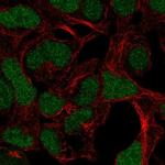 ADAMTS17 Antibody in Immunocytochemistry (ICC/IF)