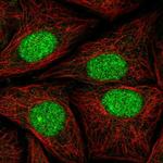 ATXN1L Antibody in Immunocytochemistry (ICC/IF)