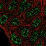 ELF5 Antibody in Immunocytochemistry (ICC/IF)