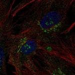 B3GNT9 Antibody in Immunocytochemistry (ICC/IF)