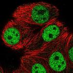 ATXN1L Antibody in Immunocytochemistry (ICC/IF)