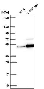 ZN692 Antibody in Western Blot (WB)