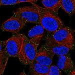 LIMD2 Antibody in Immunocytochemistry (ICC/IF)