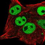 ETV5 Antibody in Immunocytochemistry (ICC/IF)