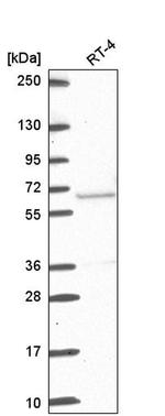 ETV5 Antibody in Western Blot (WB)