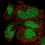 ZNF331 Antibody in Immunocytochemistry (ICC/IF)