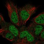 HUS1B Antibody in Immunocytochemistry (ICC/IF)