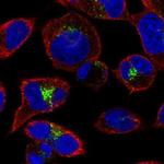 GGA2 Antibody in Immunocytochemistry (ICC/IF)