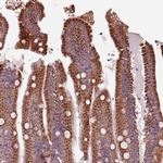 SLC25A24 Antibody in Immunohistochemistry (IHC)