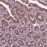 SLC25A24 Antibody in Immunohistochemistry (IHC)