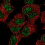 SUPT7L Antibody in Immunocytochemistry (ICC/IF)