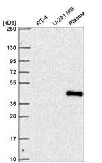 SUPT7L Antibody in Western Blot (WB)