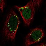 YIPF3 Antibody in Immunocytochemistry (ICC/IF)