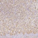 SLC18A1 Antibody in Immunohistochemistry (IHC)