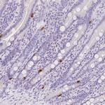 SLC18A1 Antibody in Immunohistochemistry (IHC)