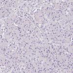 SLC18A1 Antibody in Immunohistochemistry (IHC)