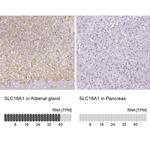 SLC18A1 Antibody