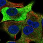 TRIB1 Antibody in Immunocytochemistry (ICC/IF)