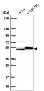 SH2D3A Antibody in Western Blot (WB)