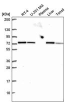 SDHA Antibody in Western Blot (WB)