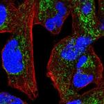 NDUFS1 Antibody in Immunocytochemistry (ICC/IF)