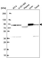 NDUFS1 Antibody in Western Blot (WB)