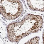 POLI Antibody in Immunohistochemistry (IHC)