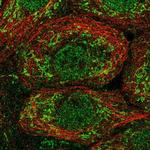 OAT Antibody in Immunocytochemistry (ICC/IF)