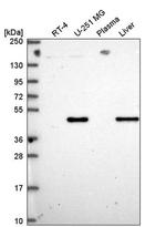 OAT Antibody in Western Blot (WB)