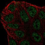 ABCA6 Antibody in Immunocytochemistry (ICC/IF)