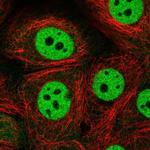 CSTF1 Antibody in Immunocytochemistry (ICC/IF)