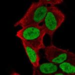 PHOX2A Antibody in Immunocytochemistry (ICC/IF)