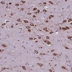 WDR83OS Antibody in Immunohistochemistry (IHC)