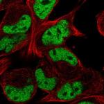 TCF12 Antibody in Immunocytochemistry (ICC/IF)