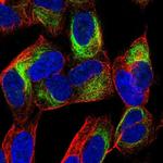 TBC1D16 Antibody in Immunocytochemistry (ICC/IF)