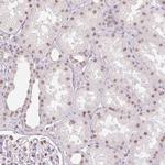 RPRD1B Antibody in Immunohistochemistry (IHC)